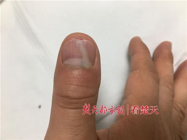 冲破黎明前的黑暗 相关产品