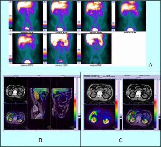 僵尸战士 产品主图